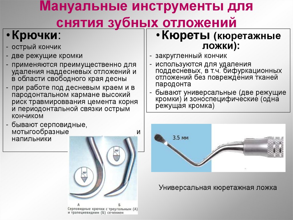Мануальные инструменты для снятия зубных отложений