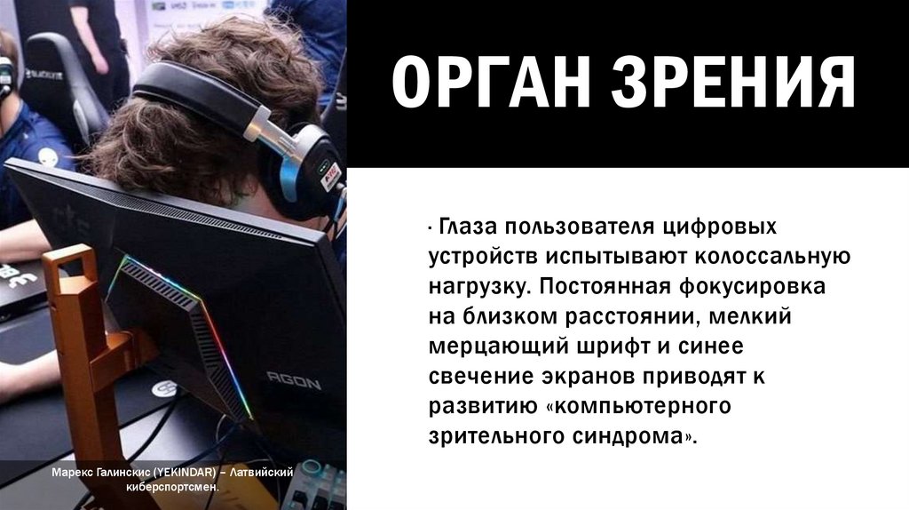 Орган зрения