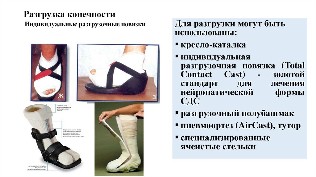 Разгрузка конечности