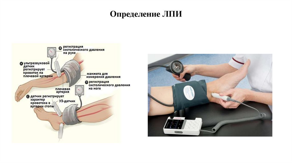 Определение ЛПИ