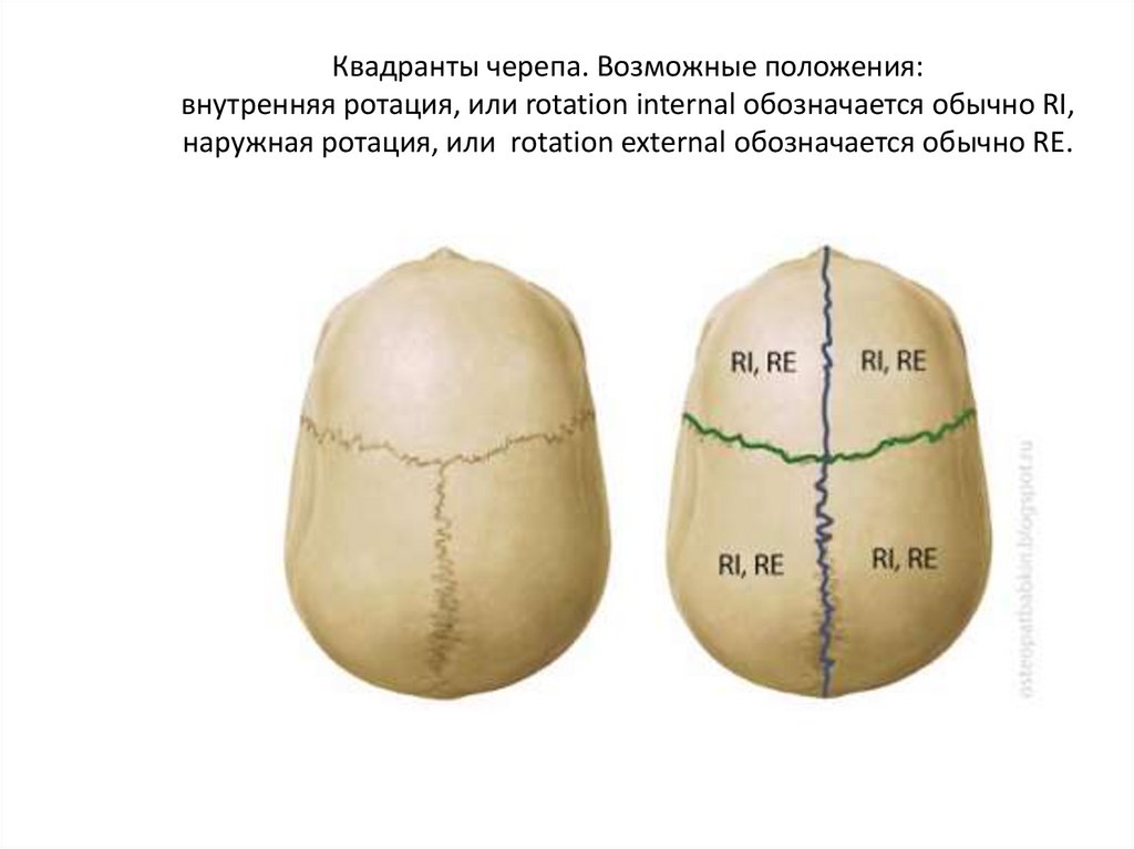 Квадранты черепа. Возможные положения: внутренняя ротация, или rotation internal обозначается обычно RI, наружная ротация, или 