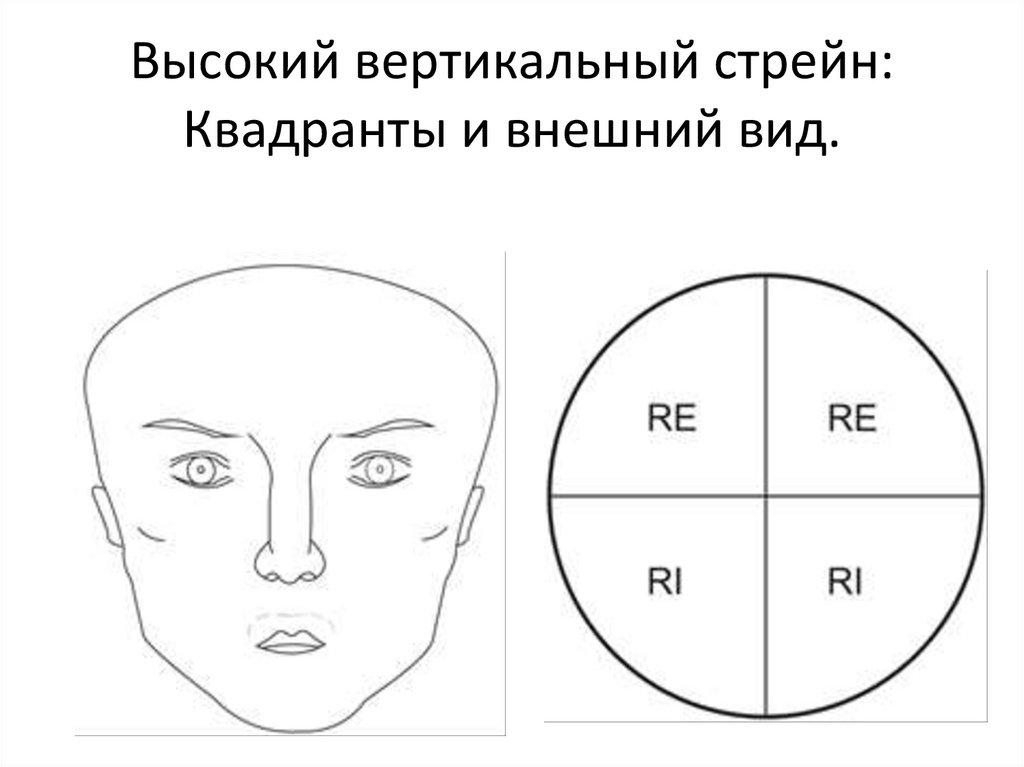 Вертикальный стрейн (высокий и низкий).