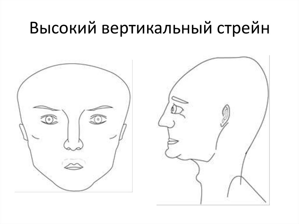 Вертикальный стрейн