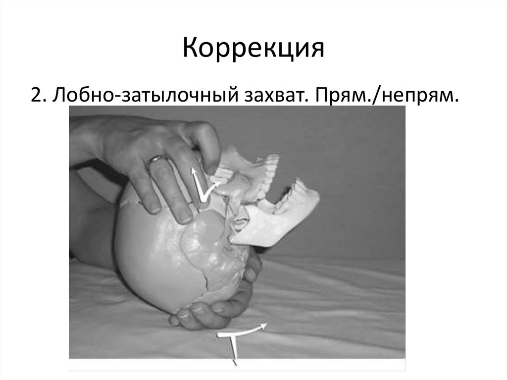 Компрессия