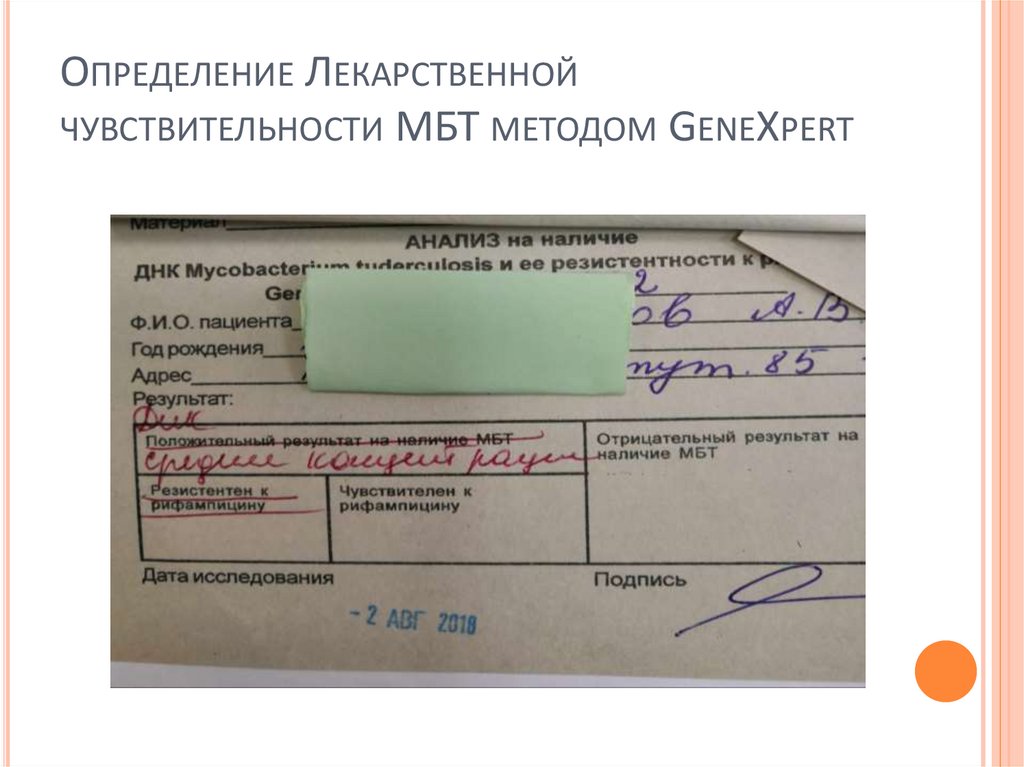 Определение Лекарственной чувствительности МБТ методом GeneXpert