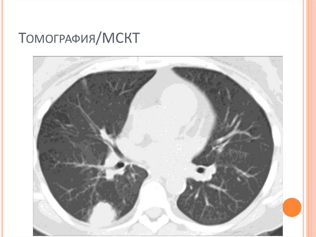 Томография/МСКТ