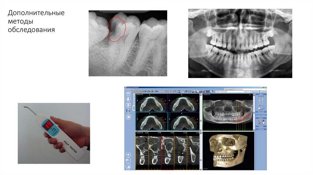 Дополнительные методы обследования