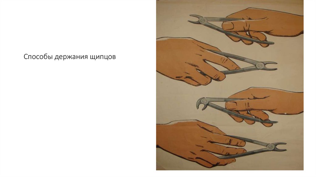 Способы держания щипцов