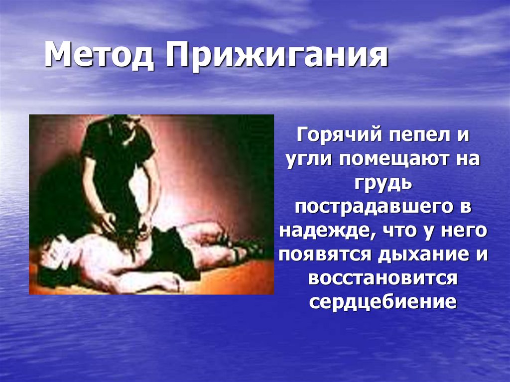 Метод Прижигания