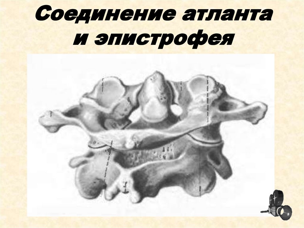 Соединение атланта и эпистрофея