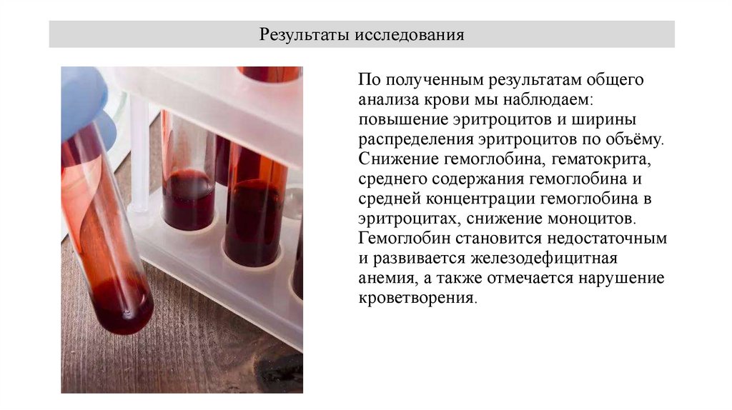 Результаты исследования