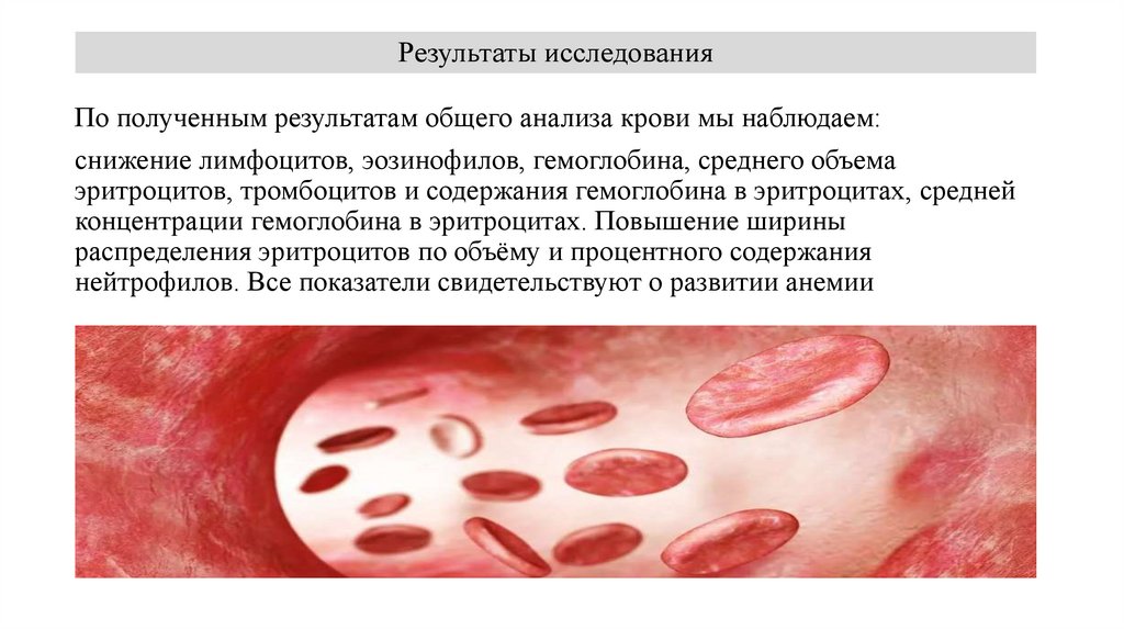 Результаты исследования