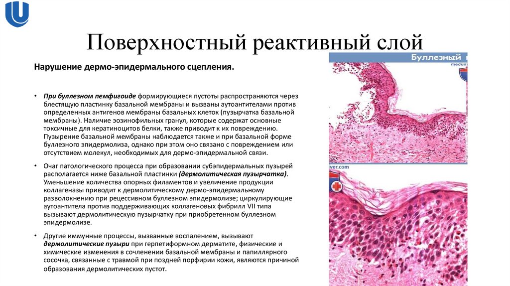 Поверхностный реактивный слой