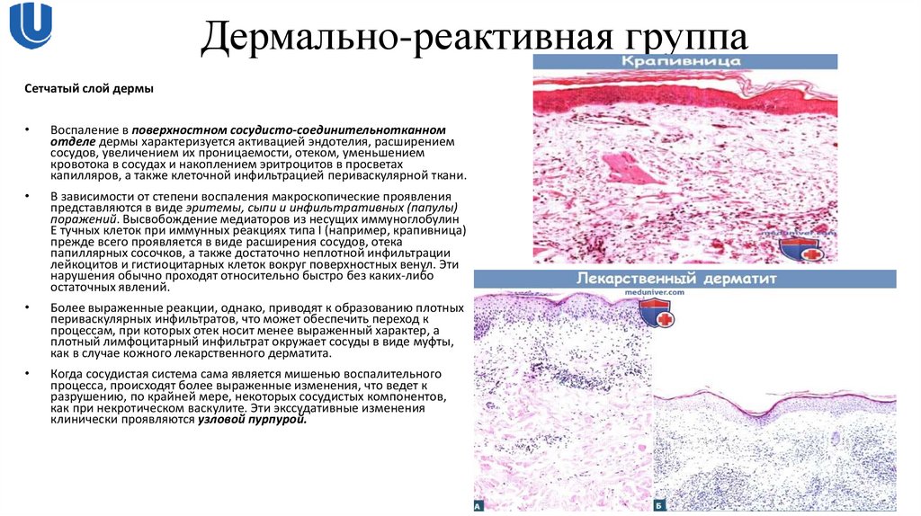 Дермально-реактивная группа