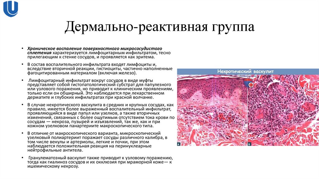 Дермально-реактивная группа