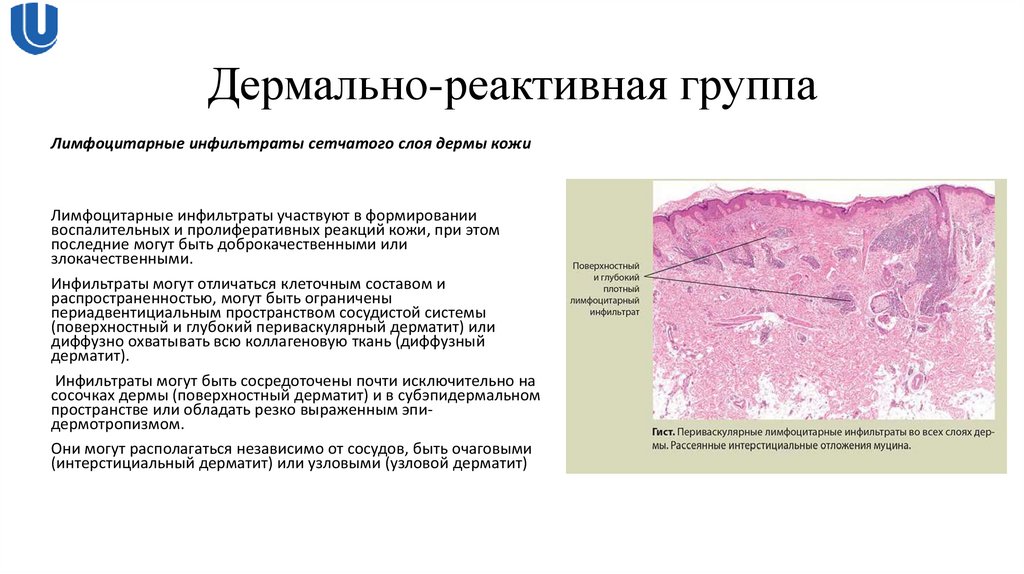 Дермально-реактивная группа