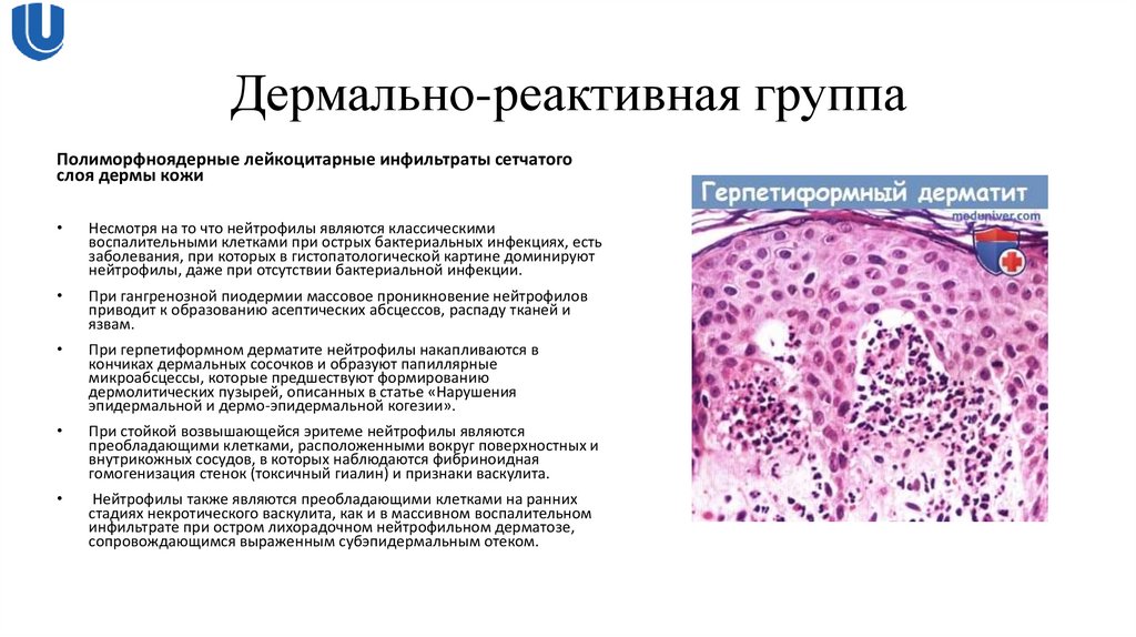 Дермально-реактивная группа