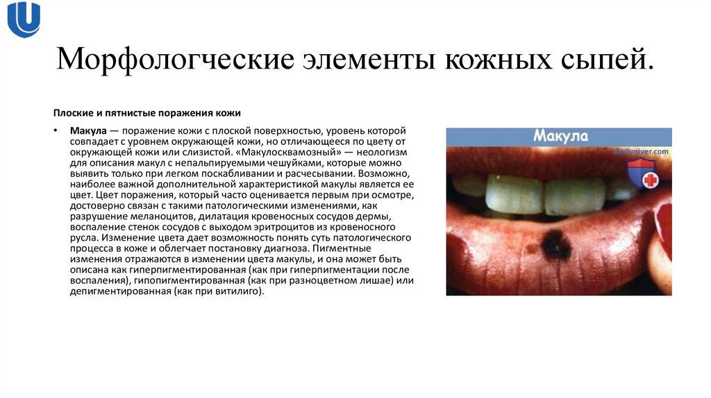 Морфологческие элементы кожных сыпей.