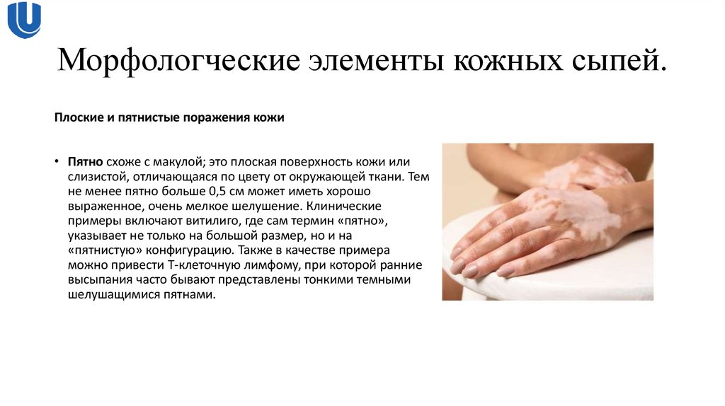 Морфологческие элементы кожных сыпей.