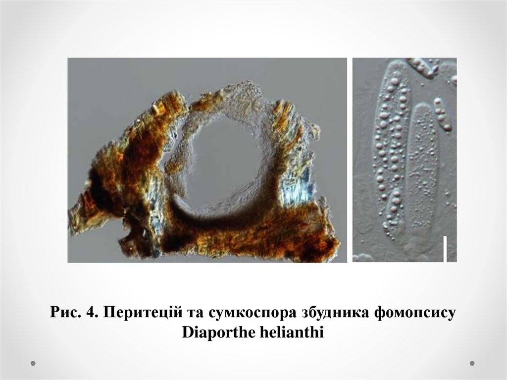Рис. 4. Перитецій та сумкоспора збудника фомопсису Diaporthe helianthi