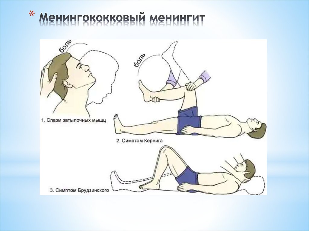 Менингококковый менингит