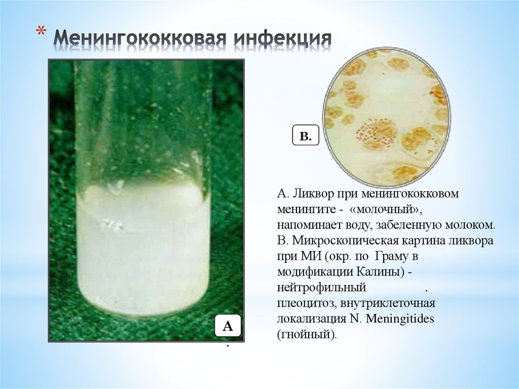 Менингококковая инфекция