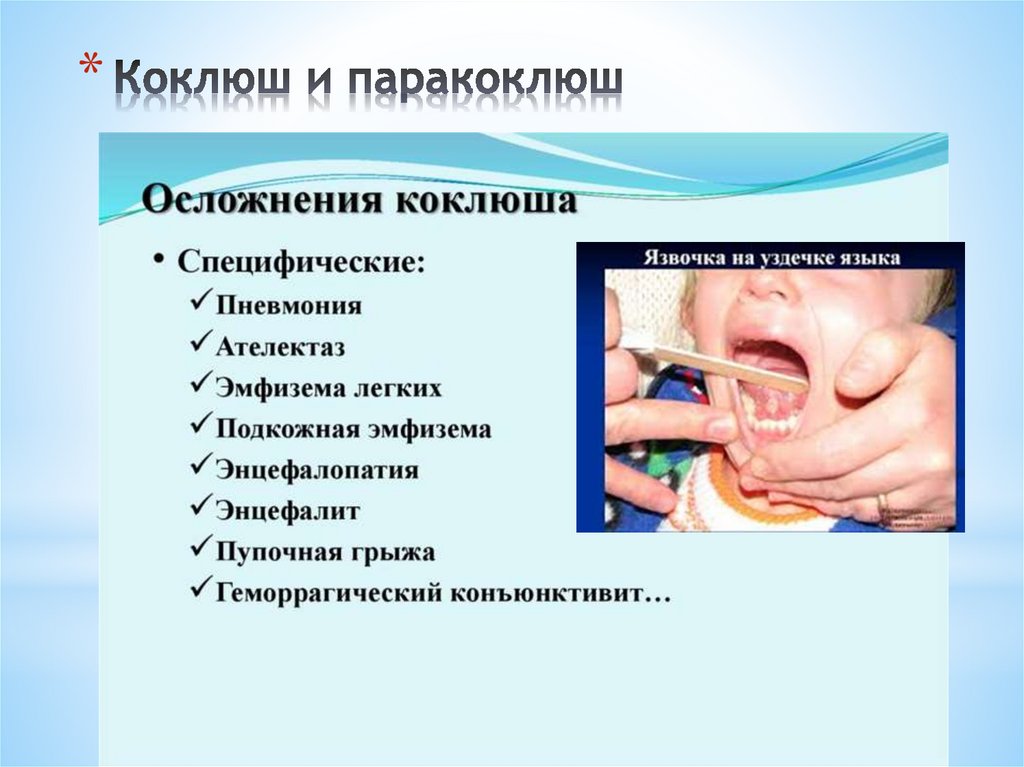 Коклюш и паракоклюш