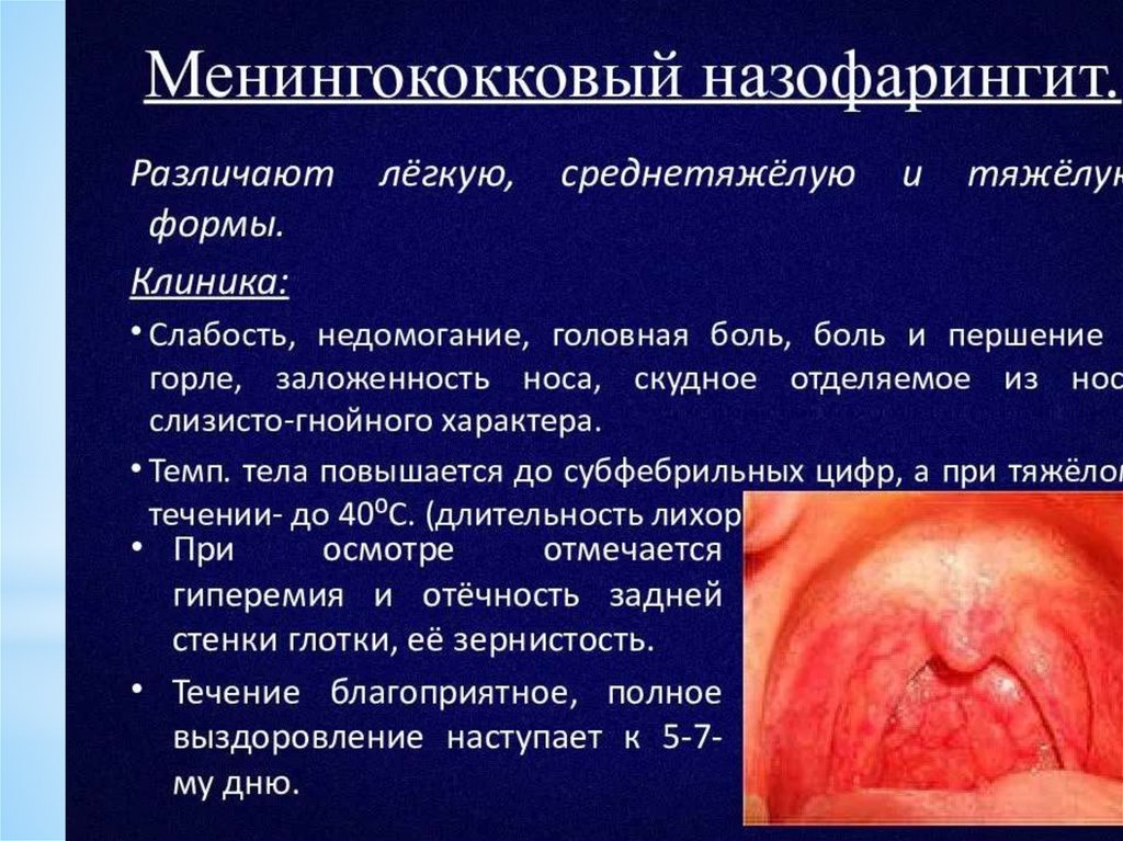 Менингококковая инфекция