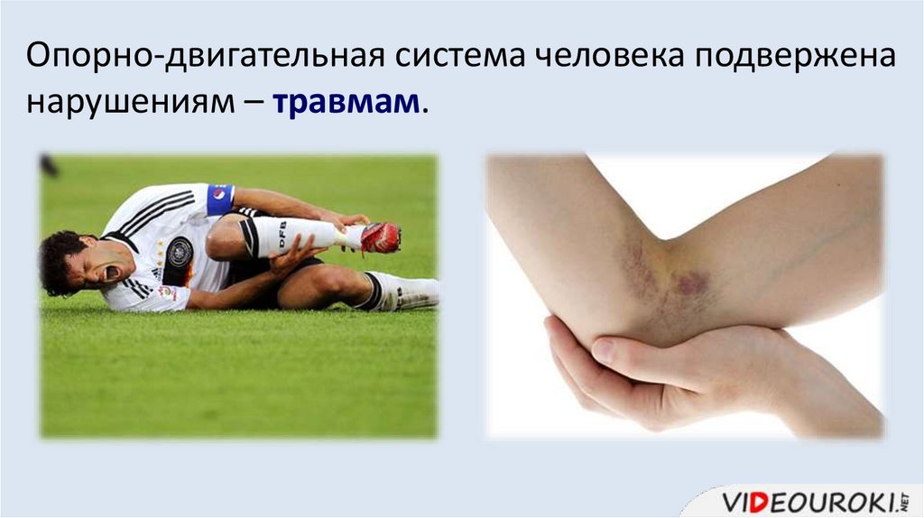 Опорно-двигательная система человека подвержена нарушениям – травмам.
