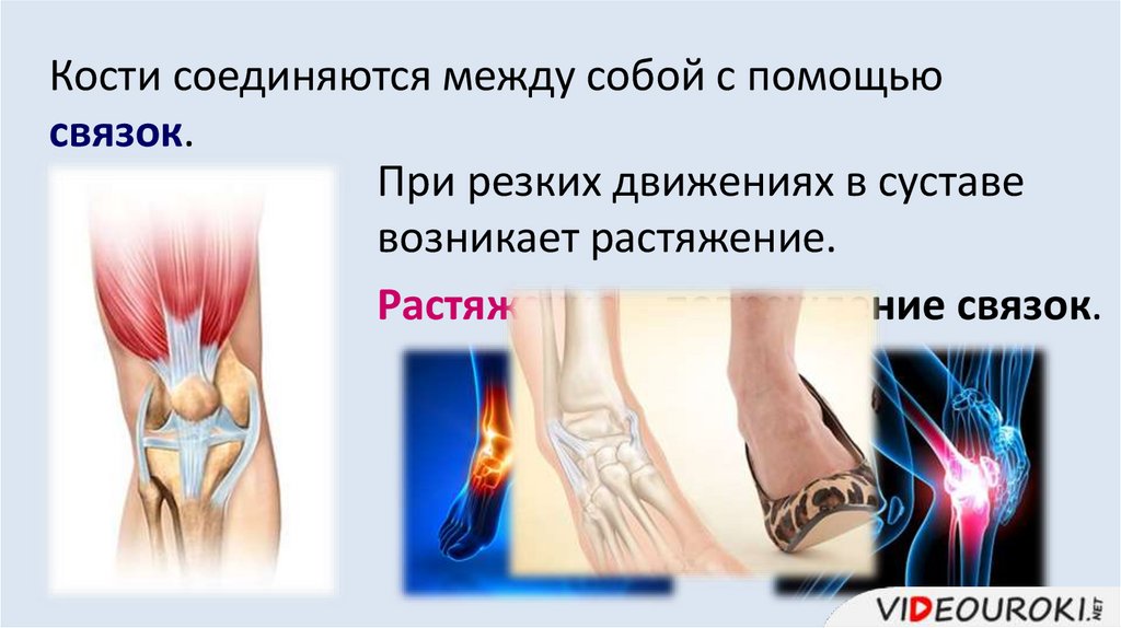 Кости соединяются между собой с помощью связок.