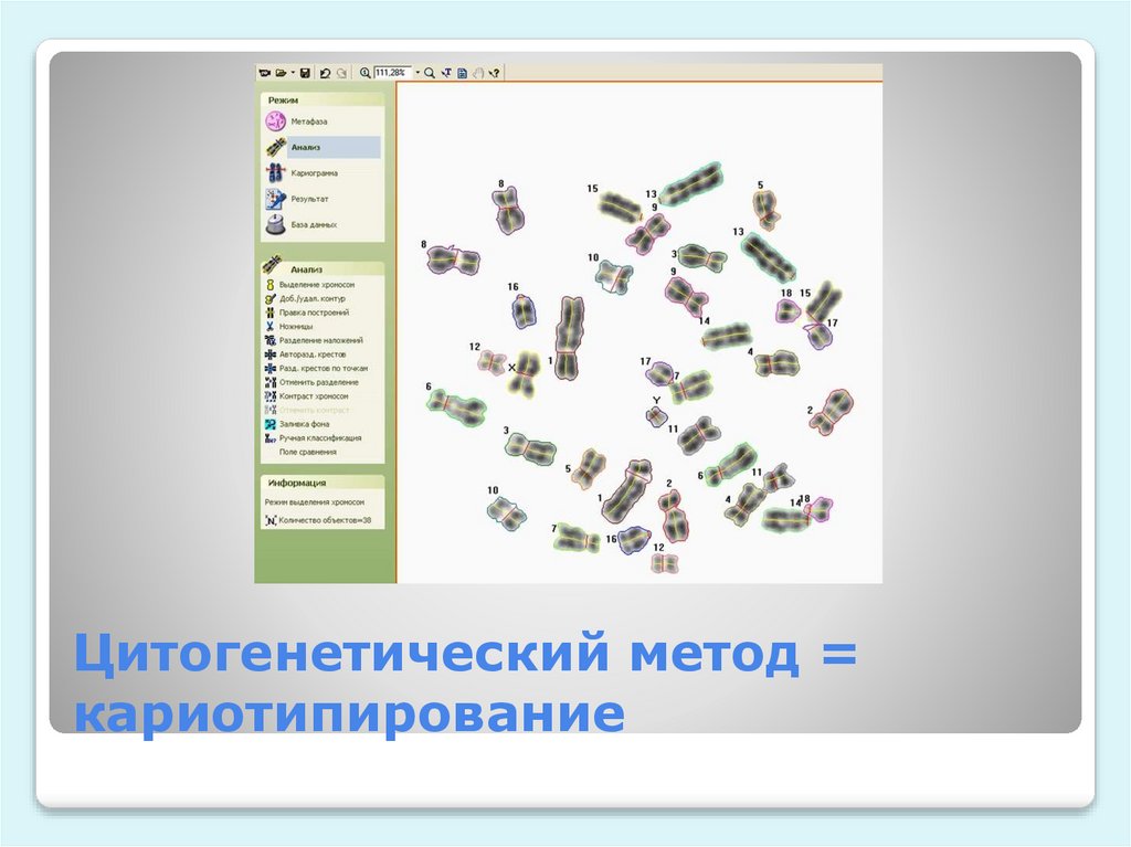 Цитогенетический метод = кариотипирование