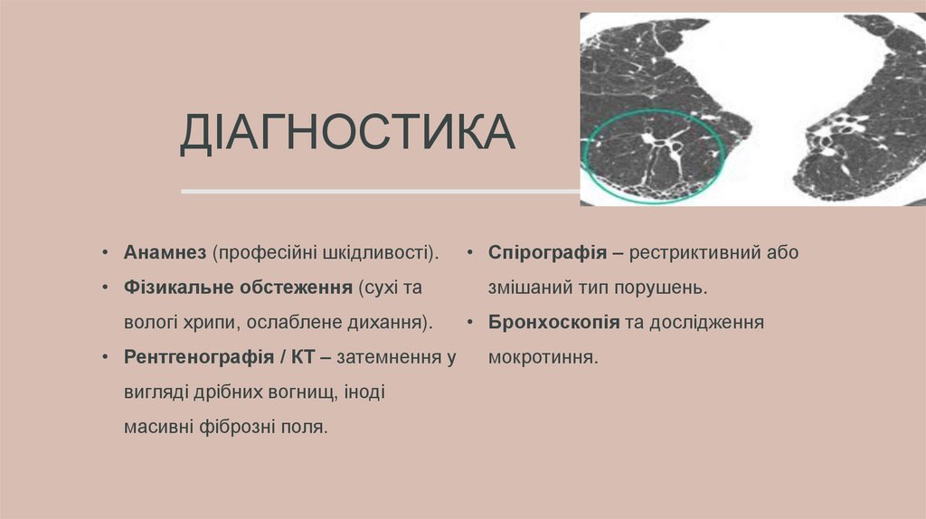 Діагностика