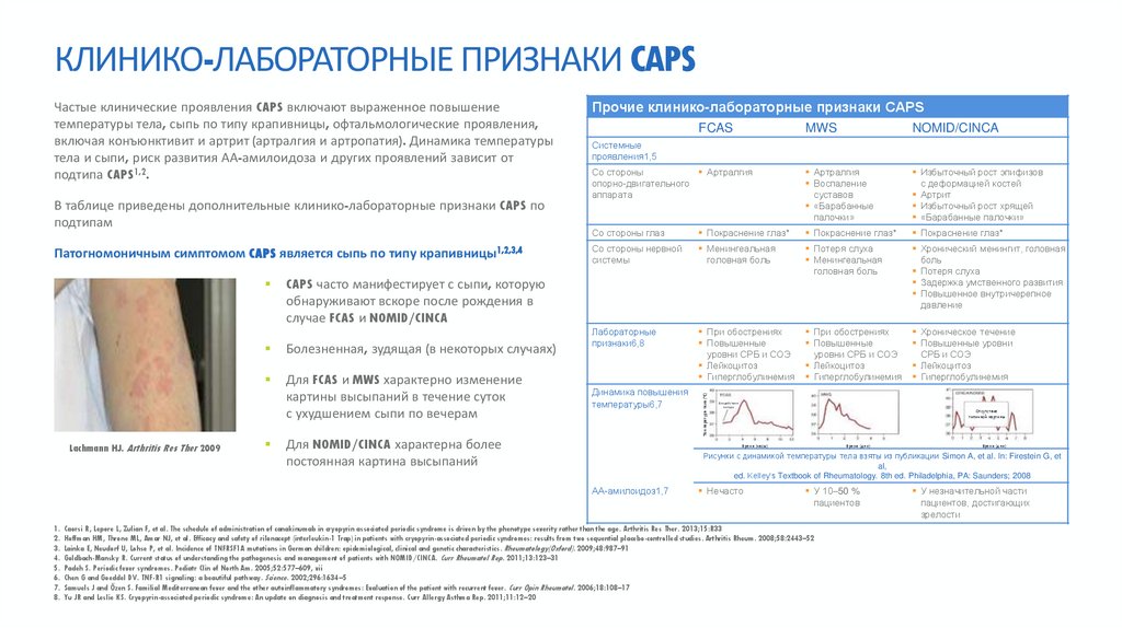 КЛИНИКО-ЛАБОРАТОРНЫЕ ПРИЗНАКИ CAPS