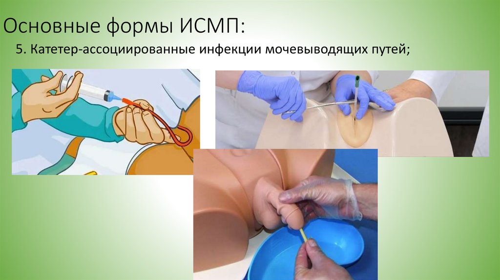 Основные формы ИСМП: