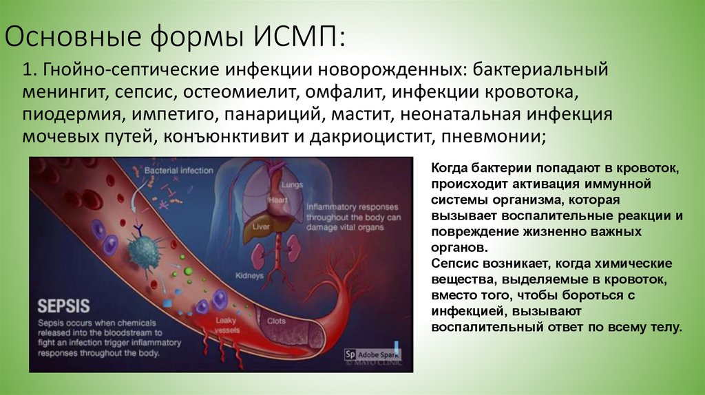 Основные формы ИСМП: