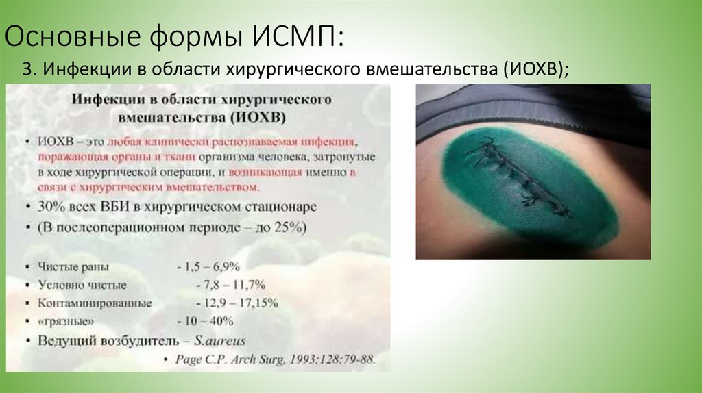 Основные формы ИСМП: