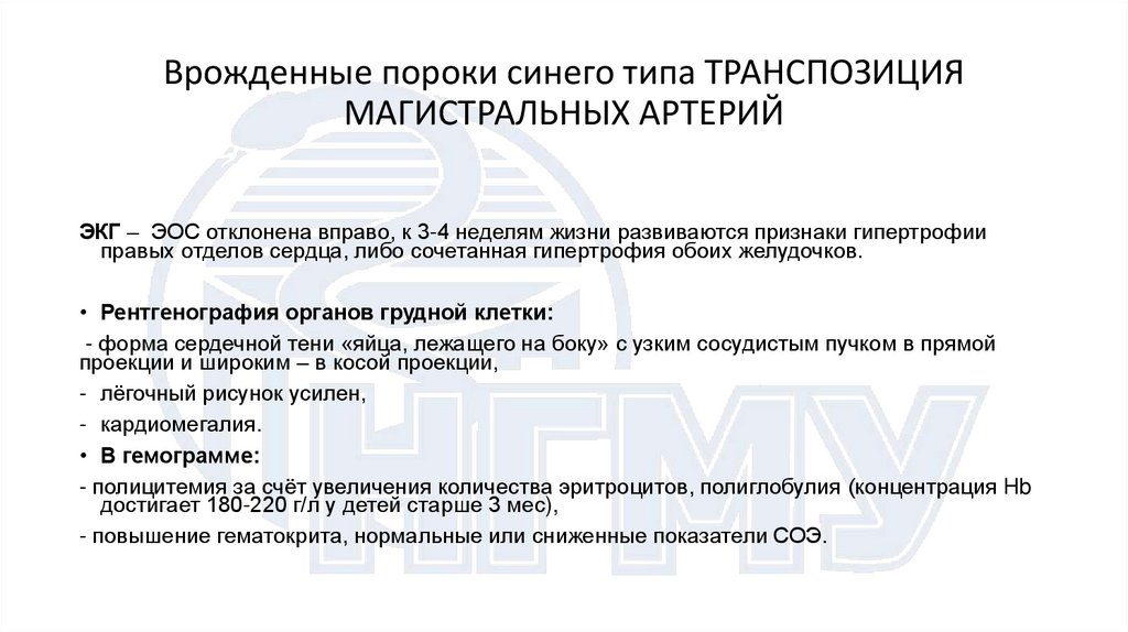 Врожденные пороки синего типа ТРАНСПОЗИЦИЯ МАГИСТРАЛЬНЫХ АРТЕРИЙ