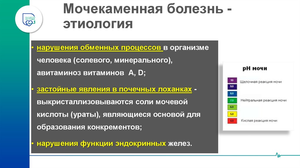Мочекаменная болезнь - этиология