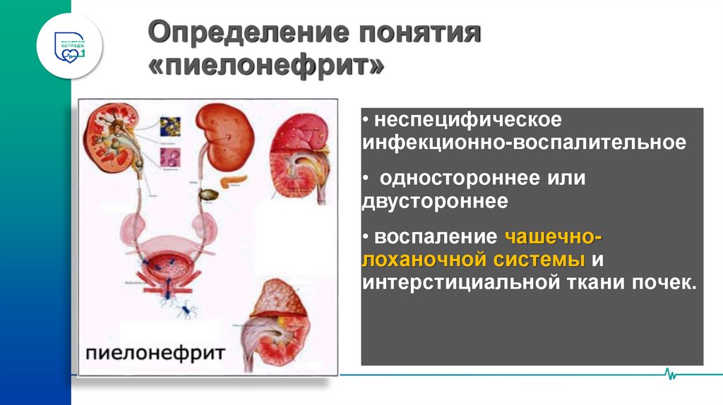 Определение понятия «пиелонефрит»