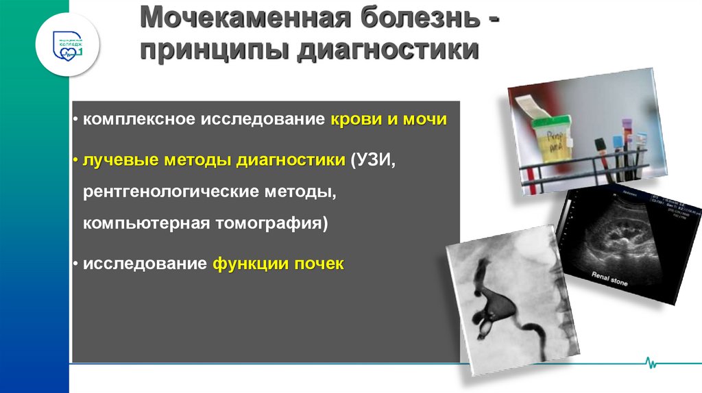 Мочекаменная болезнь -принципы диагностики