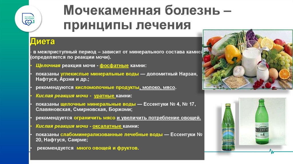 Мочекаменная болезнь – принципы лечения