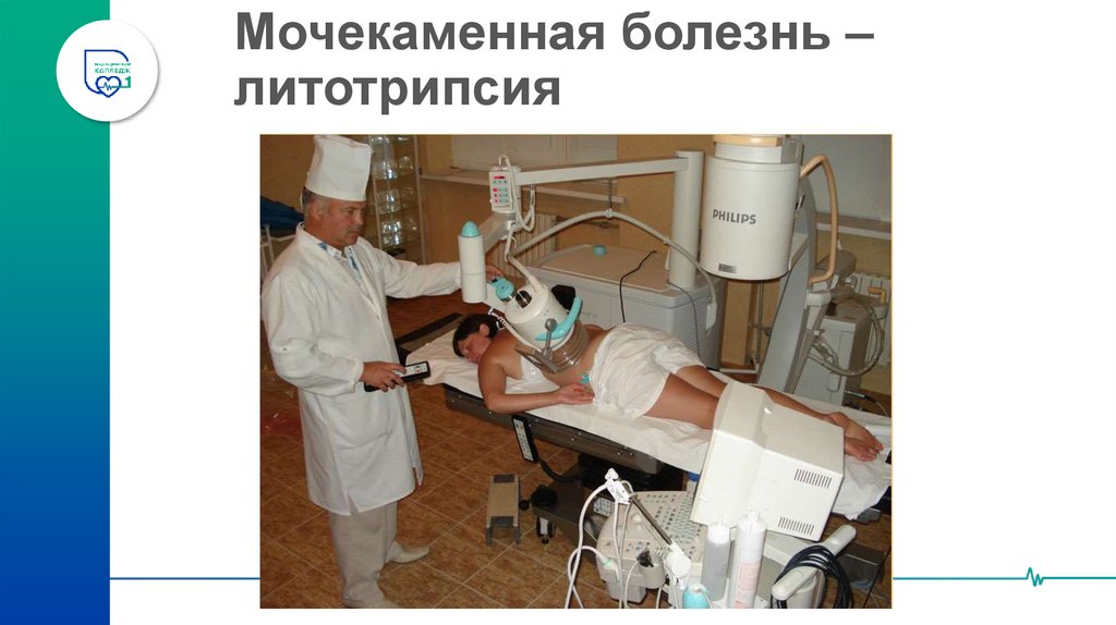 Мочекаменная болезнь – литотрипсия