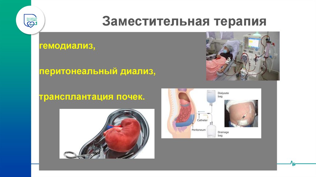 Заместительная терапия