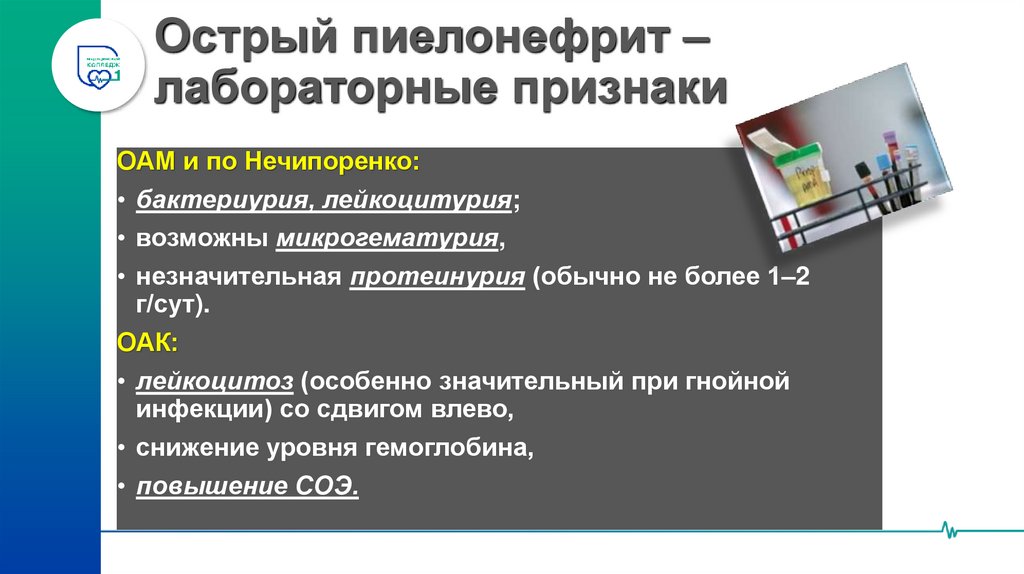 Острый пиелонефрит – лабораторные признаки