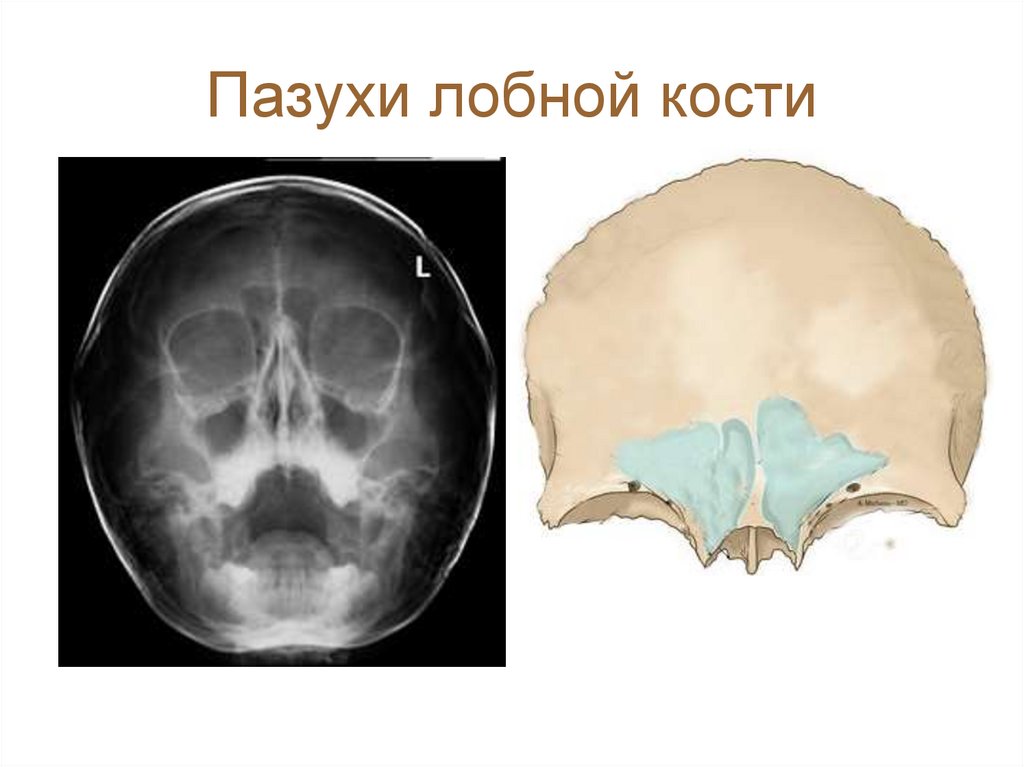 Пазухи лобной кости