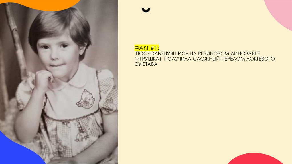 ФАКТ #1: поскользнувшись на резиновом динозавре (игрушка) получила сложный перелом локтевого сустава