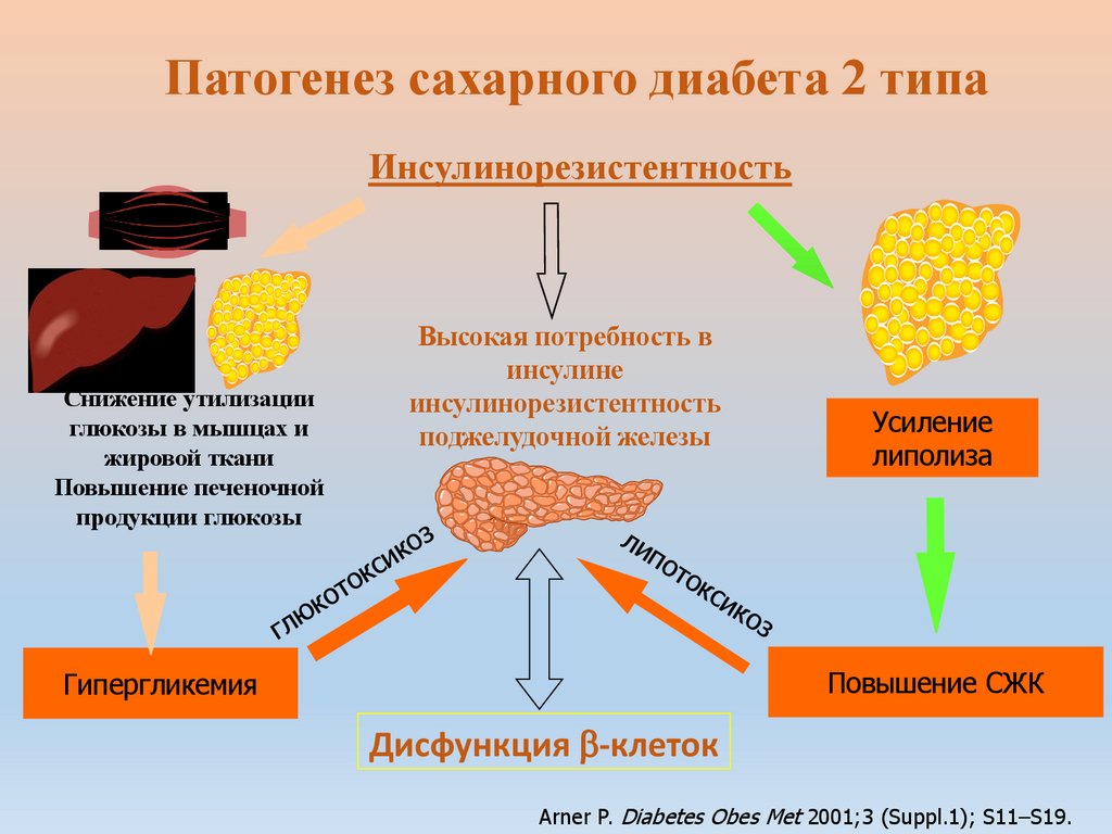 Патогенез сахарного диабета 2 типа