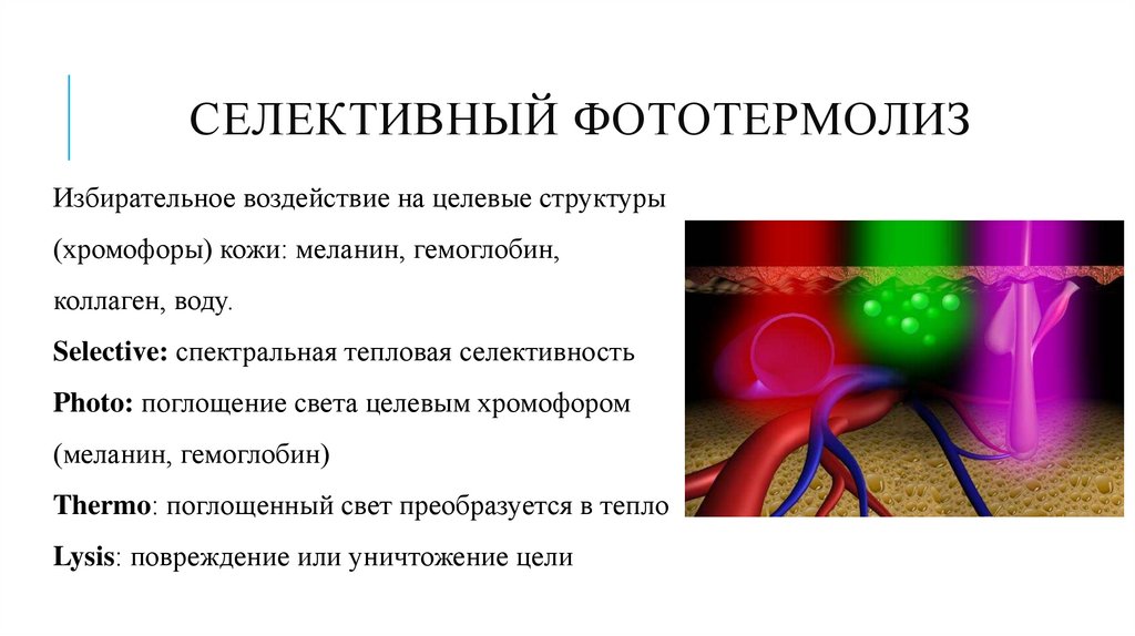 Селективный фототермолиз