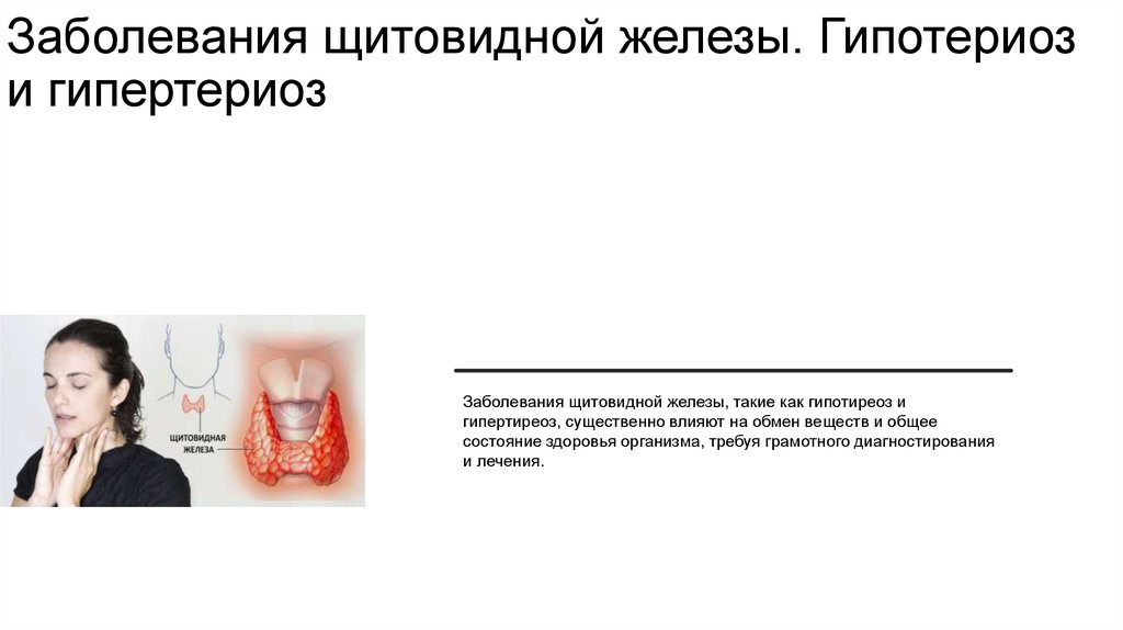 Заболевания щитовидной железы. Гипотериоз и гипертериоз