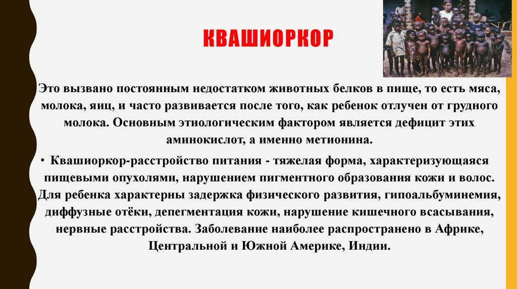 Квашиоркор